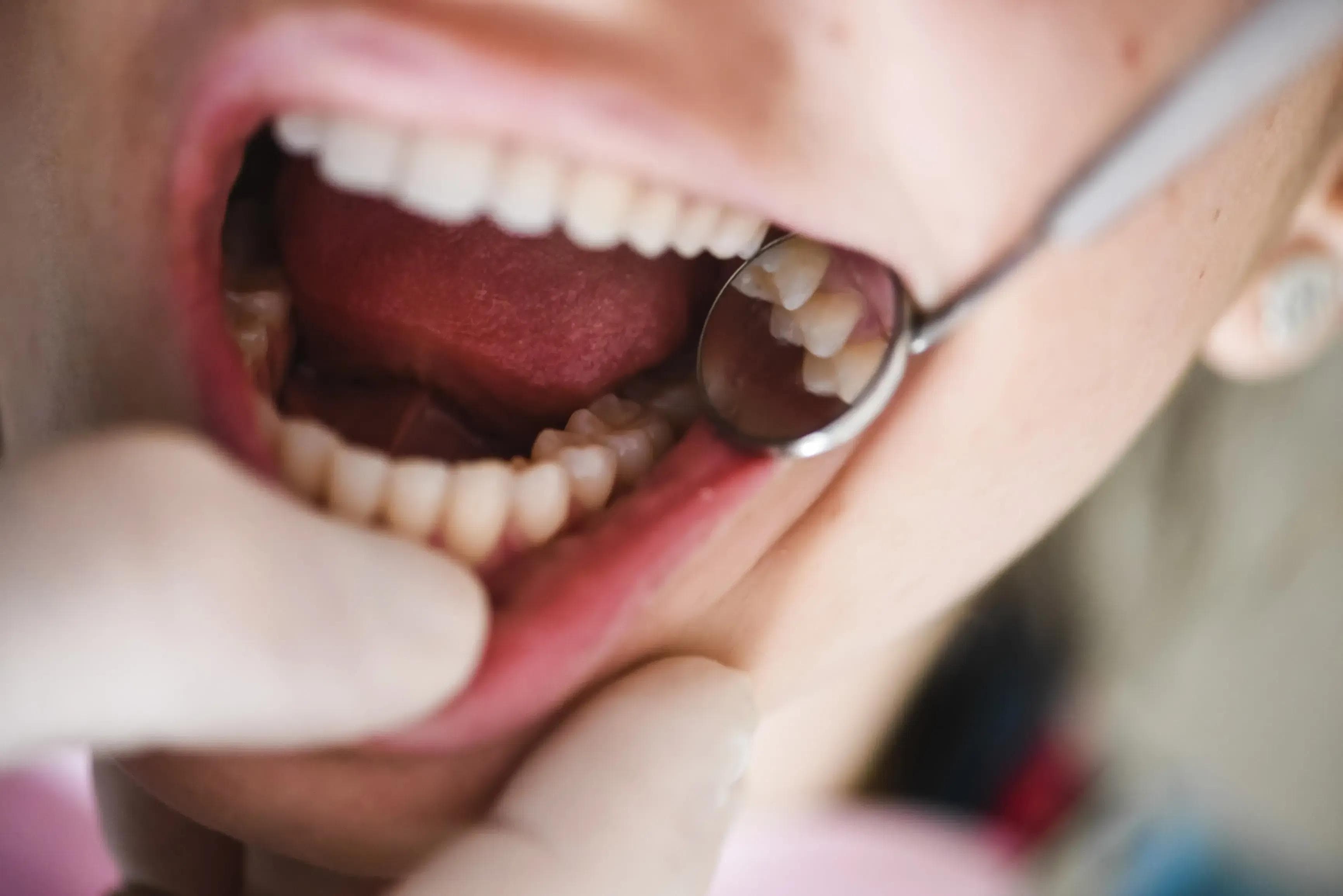 The importance of regular dental check-ups preview
